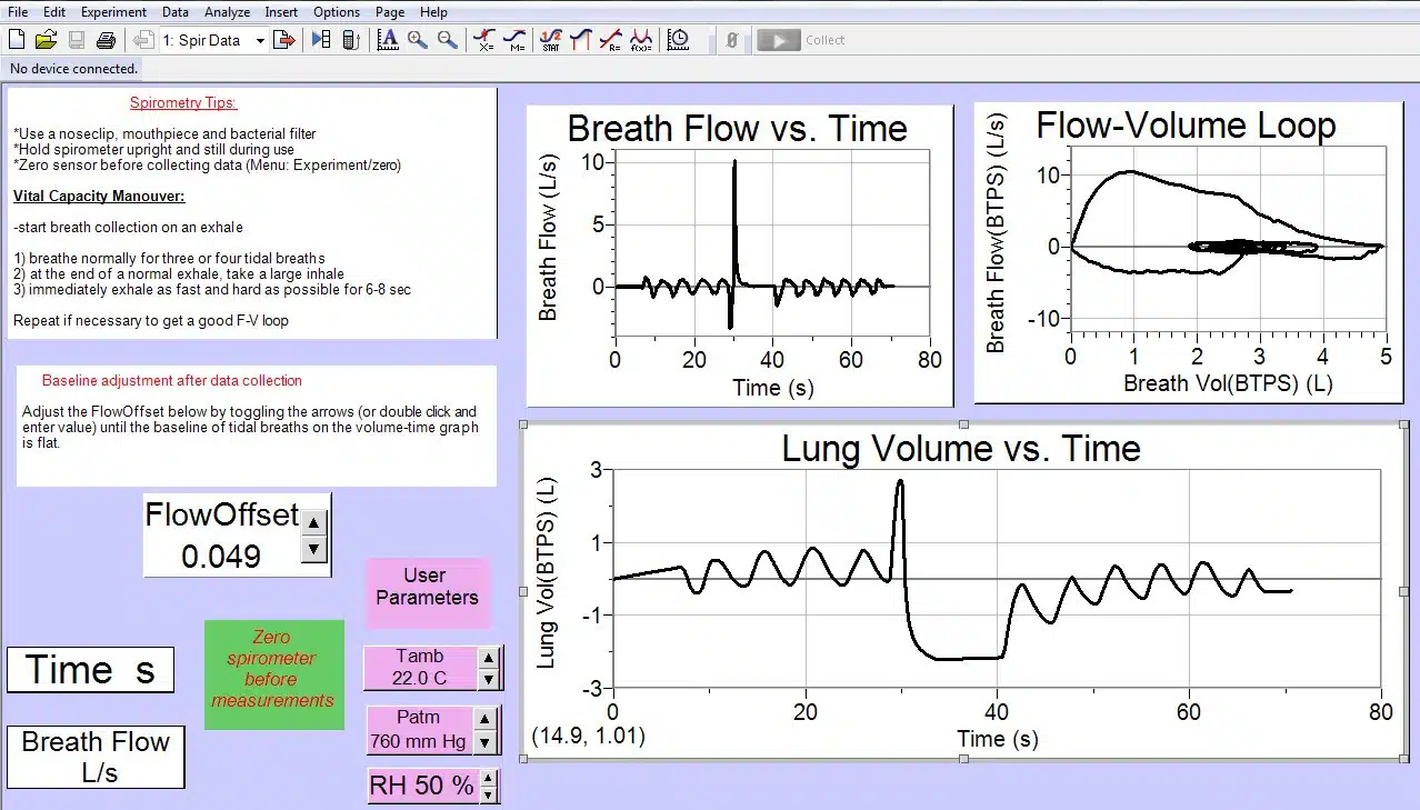 VC maneuver data Spirometry data